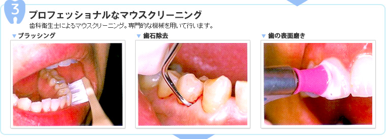 3.プロフェッショナルなマウスクリーニング